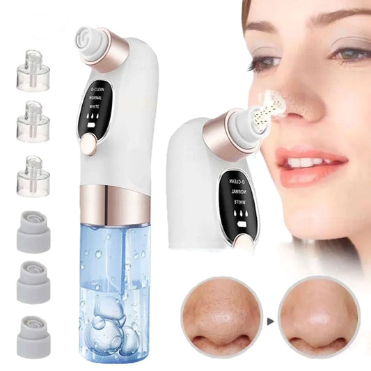 Electric Pore Vacuum Cleaner