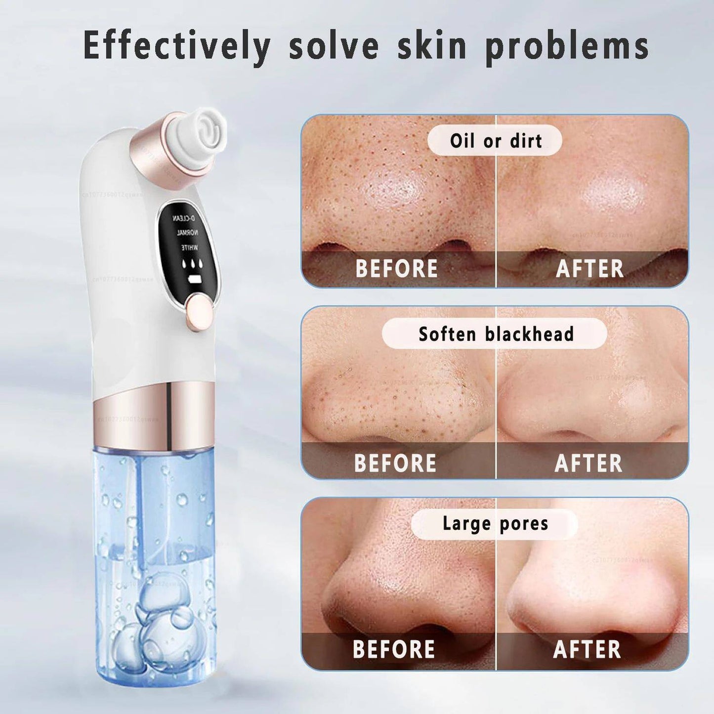 Electric Pore Vacuum Cleaner